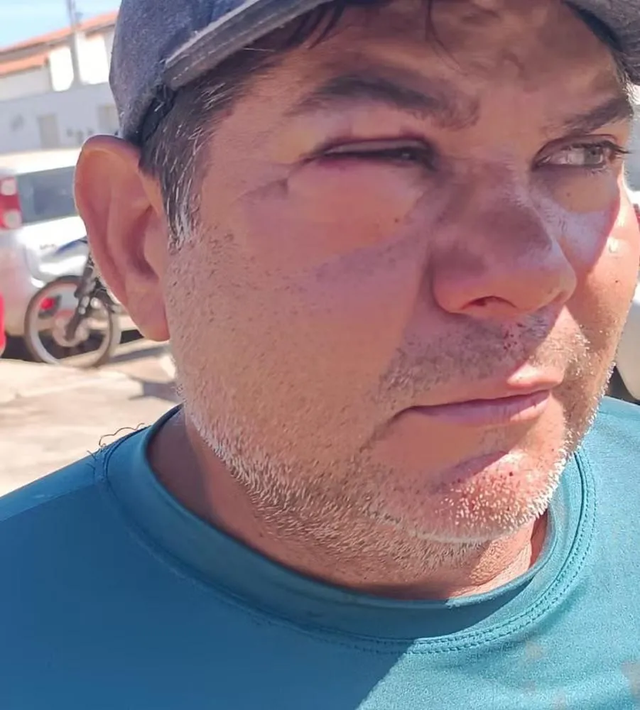 Servidor da prefeitura de São Raimundo Nonato relata ter sido agredido enquanto recolhia vacas na rua — Foto: Reprodução