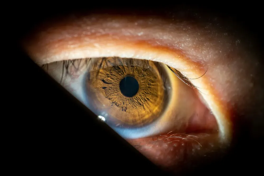Cirurgia única para tratar glaucoma e catarata será oferecida pelo SUS
